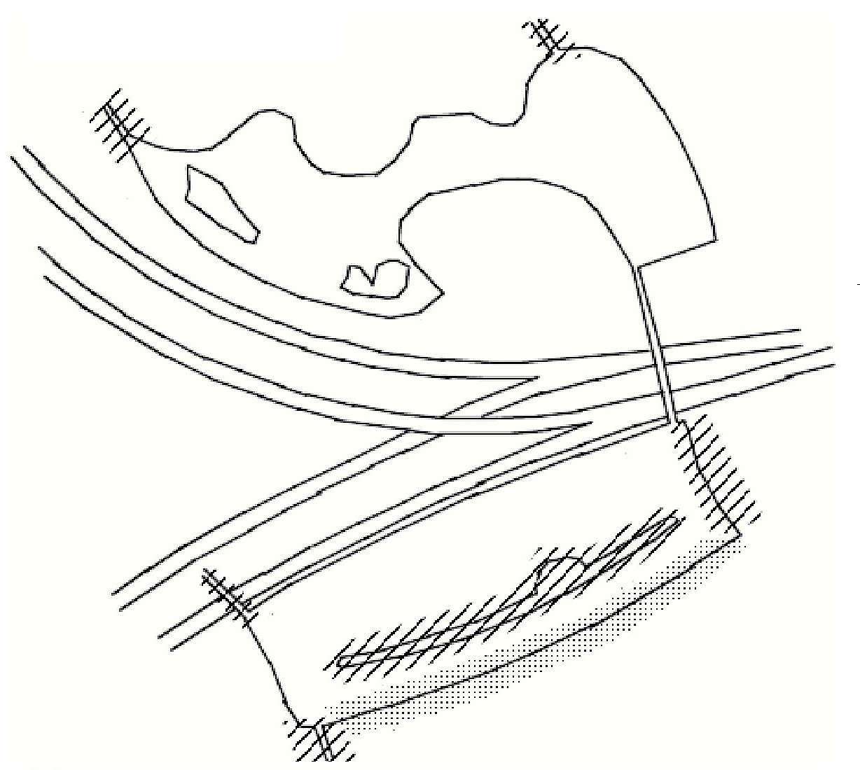 Bemrk oplysningerne herunder om de markerede omrder.